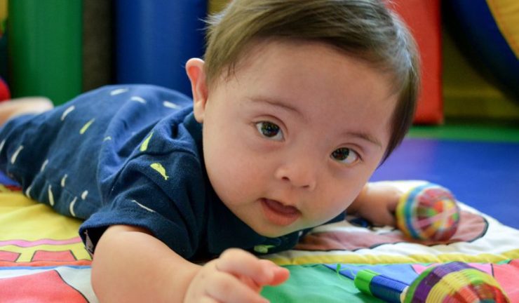 Intervención temprana en Síndrome de Down