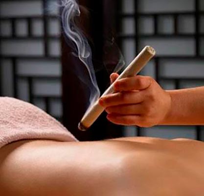 Salud integral. Terapias complementarias: Moxibustión