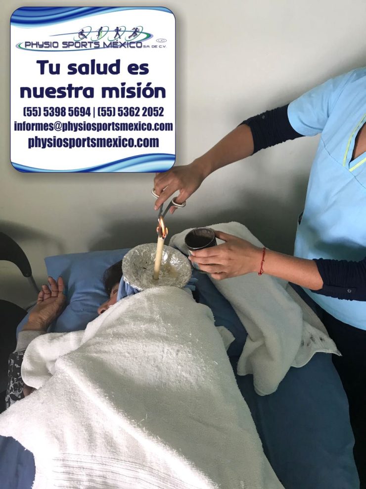 Conoterapia o Ear Coning. Physio Sports México