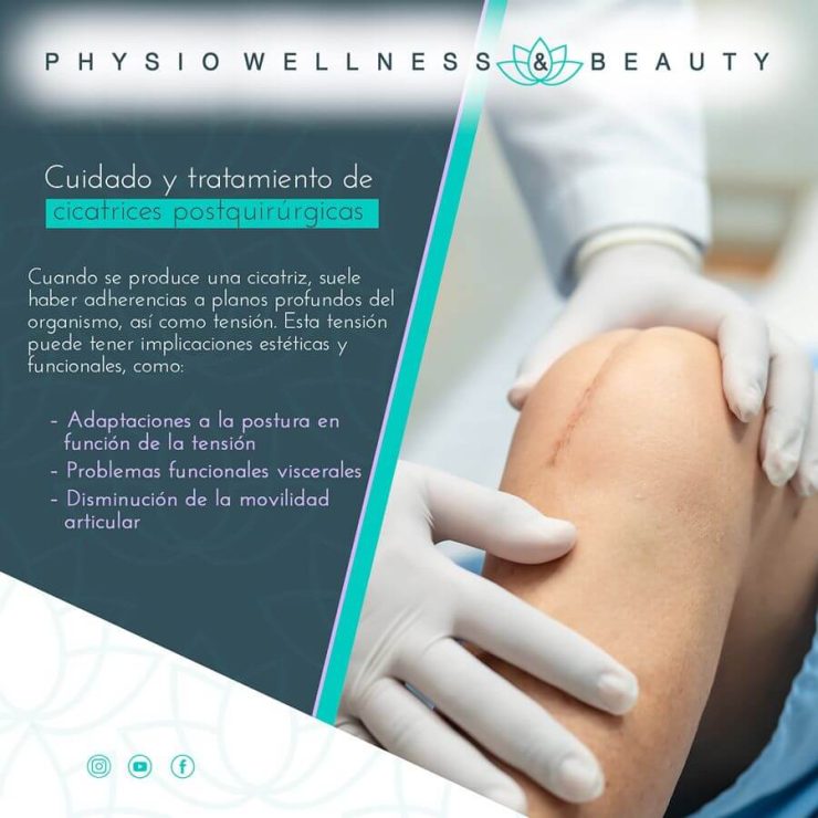 Cuidado y tratamiento de cicatrices postquirúrgicas