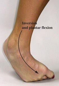 Esguince de tobillo 1