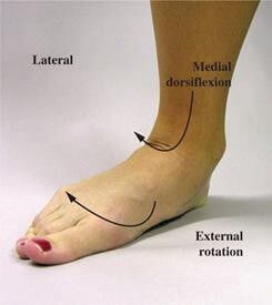 Esguince de tobillo 3