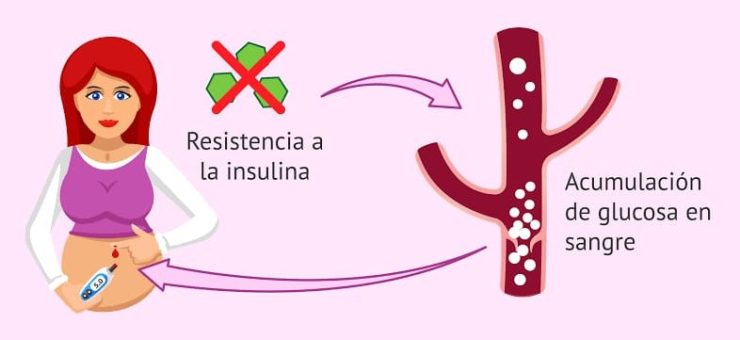Resistencia a la insulina