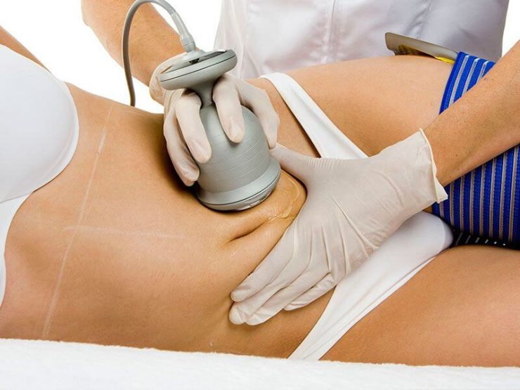 Beneficios de la Ultracavitación