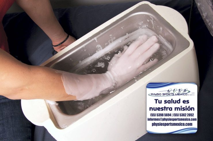 Baño de parafina para el dolor por artritis reumatoride